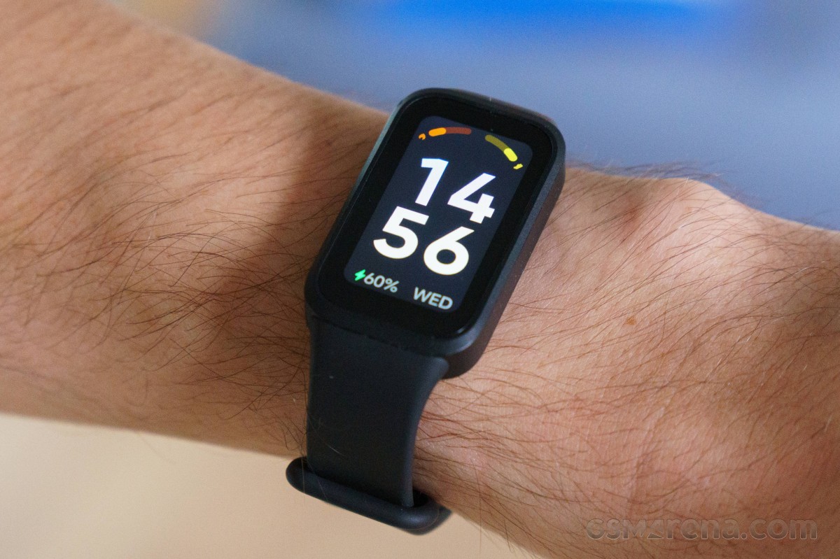 Xiaomi Smart Band 9 Active Price in Bangladesh – Best Deal at SHAGADGET